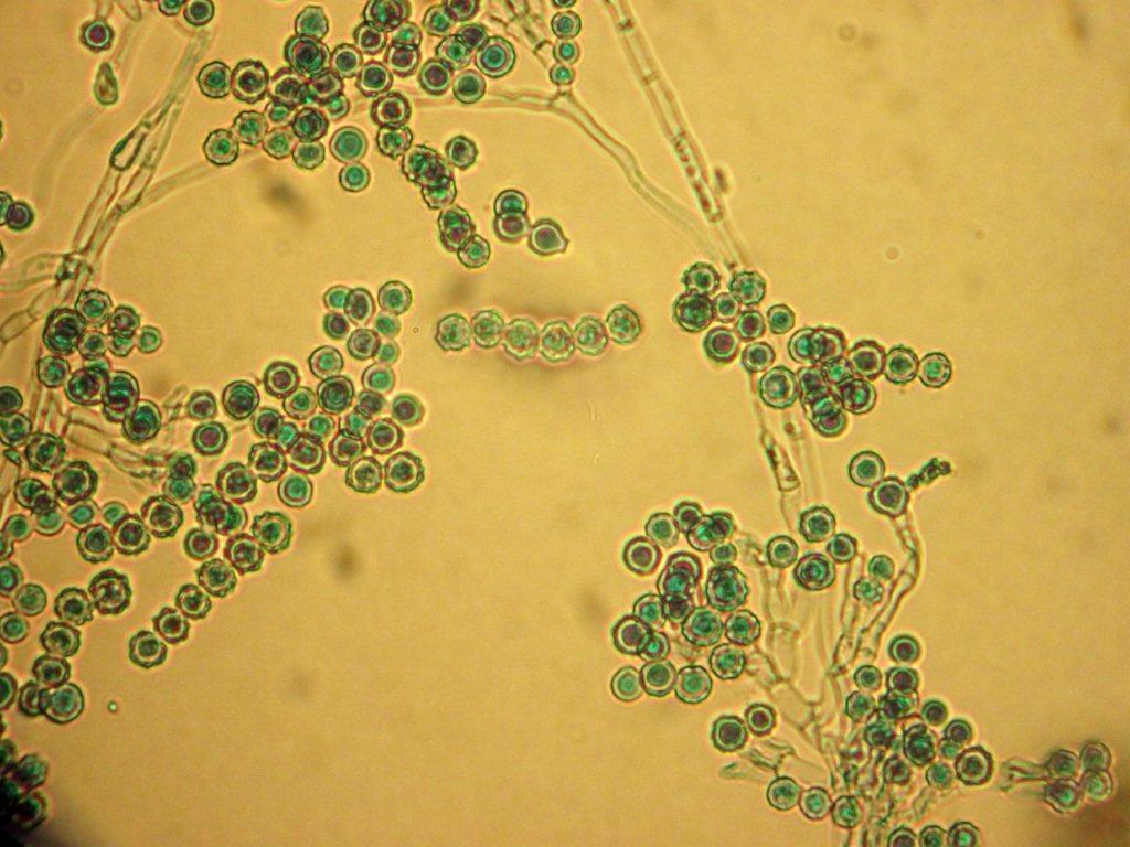 Scopulariopsis brevicaulis | © Omar Cerna, www.flickr.com